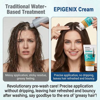 𝐎𝐟𝐟𝐢𝐜𝐢𝐚𝐥 𝐔𝐒 𝐒𝐭𝐨𝐫𝐞 ⭐💖🇺🇸  | Regrow Thicker Hair: EPIGENIX® 5% Minoxidil Pre-Shampoo Cream (No Grease!)