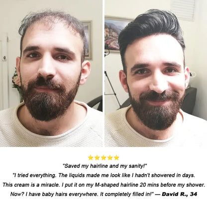𝐎𝐟𝐟𝐢𝐜𝐢𝐚𝐥 𝐔𝐒 𝐒𝐭𝐨𝐫𝐞 ⭐💖🇺🇸  | Regrow Thicker Hair: EPIGENIX® 5% Minoxidil Pre-Shampoo Cream (No Grease!)