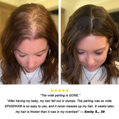 𝐎𝐟𝐟𝐢𝐜𝐢𝐚𝐥 𝐔𝐒 𝐒𝐭𝐨𝐫𝐞 ⭐💖🇺🇸  | Regrow Thicker Hair: EPIGENIX® 5% Minoxidil Pre-Shampoo Cream (No Grease!)