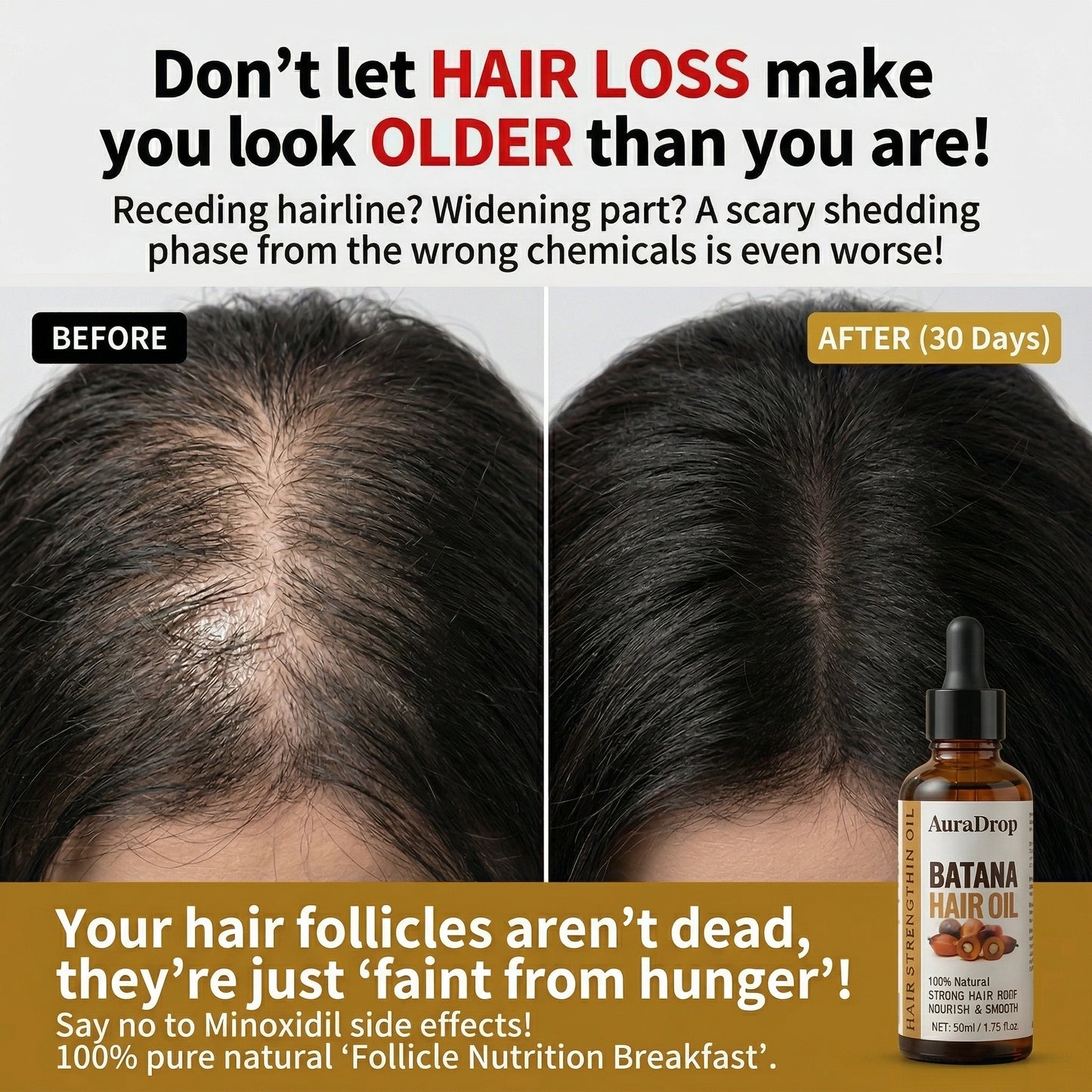 𝐎𝐟𝐟𝐢𝐜𝐢𝐚𝐥 𝐔𝐒 𝐒𝐭𝐨𝐫𝐞 🇺🇸  |  𝐀𝐮𝐫𝐚𝐃𝐫𝐨𝐩® 𝟏𝟎𝟎% 𝐏𝐮𝐫𝐞 𝐁𝐚𝐭𝐚𝐧𝐚 · 𝐕𝐢𝐭𝐚𝐦𝐢𝐧 𝐄 × 𝐎𝐦𝐞𝐠𝐚-𝟔 𝐔𝐥𝐭𝐫𝐚-𝐌𝐢𝐜𝐫𝐨 𝐌𝐨𝐥𝐞𝐜𝐮𝐥𝐚𝐫 𝐑𝐞𝐠𝐫𝐨𝐰𝐭𝐡 𝐎𝐢𝐥 — 𝟔𝟎 𝐒𝐞𝐜𝐨𝐧𝐝𝐬 𝐍𝐢𝐠𝐡𝐭𝐥𝐲, 𝐕𝐢𝐬𝐢𝐛𝐥𝐞 𝐁𝐚𝐛𝐲 𝐇𝐚𝐢𝐫𝐬 𝐢𝐧 𝟒 𝐖𝐞𝐞𝐤𝐬
