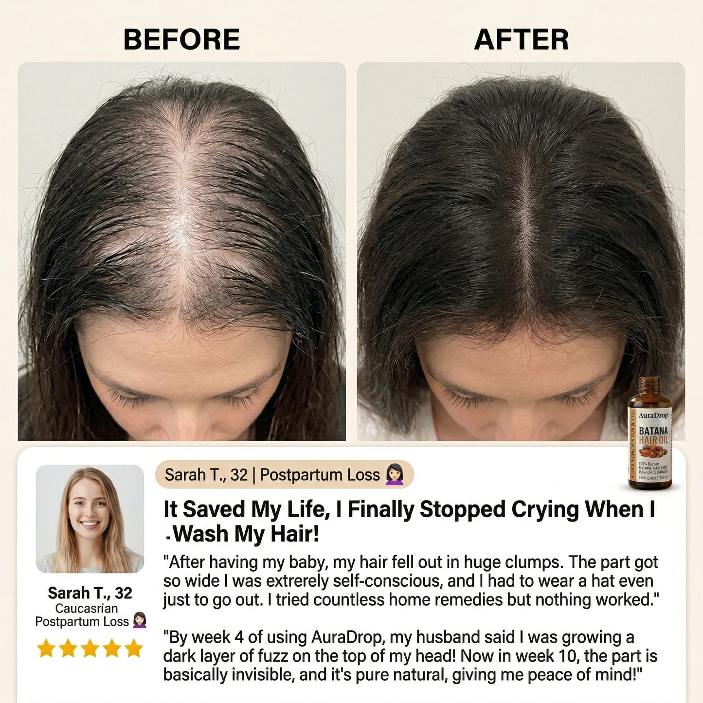 𝐎𝐟𝐟𝐢𝐜𝐢𝐚𝐥 𝐔𝐒 𝐒𝐭𝐨𝐫𝐞 🇺🇸  |  𝐀𝐮𝐫𝐚𝐃𝐫𝐨𝐩® 𝟏𝟎𝟎% 𝐏𝐮𝐫𝐞 𝐁𝐚𝐭𝐚𝐧𝐚 · 𝐕𝐢𝐭𝐚𝐦𝐢𝐧 𝐄 × 𝐎𝐦𝐞𝐠𝐚-𝟔 𝐔𝐥𝐭𝐫𝐚-𝐌𝐢𝐜𝐫𝐨 𝐌𝐨𝐥𝐞𝐜𝐮𝐥𝐚𝐫 𝐑𝐞𝐠𝐫𝐨𝐰𝐭𝐡 𝐎𝐢𝐥 — 𝟔𝟎 𝐒𝐞𝐜𝐨𝐧𝐝𝐬 𝐍𝐢𝐠𝐡𝐭𝐥𝐲, 𝐕𝐢𝐬𝐢𝐛𝐥𝐞 𝐁𝐚𝐛𝐲 𝐇𝐚𝐢𝐫𝐬 𝐢𝐧 𝟒 𝐖𝐞𝐞𝐤𝐬