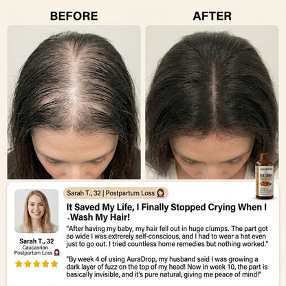 𝐎𝐟𝐟𝐢𝐜𝐢𝐚𝐥 𝐔𝐒 𝐒𝐭𝐨𝐫𝐞 🇺🇸  |  𝐀𝐮𝐫𝐚𝐃𝐫𝐨𝐩® 𝟏𝟎𝟎% 𝐏𝐮𝐫𝐞 𝐁𝐚𝐭𝐚𝐧𝐚 · 𝐕𝐢𝐭𝐚𝐦𝐢𝐧 𝐄 × 𝐎𝐦𝐞𝐠𝐚-𝟔 𝐔𝐥𝐭𝐫𝐚-𝐌𝐢𝐜𝐫𝐨 𝐌𝐨𝐥𝐞𝐜𝐮𝐥𝐚𝐫 𝐑𝐞𝐠𝐫𝐨𝐰𝐭𝐡 𝐎𝐢𝐥 — 𝟔𝟎 𝐒𝐞𝐜𝐨𝐧𝐝𝐬 𝐍𝐢𝐠𝐡𝐭𝐥𝐲, 𝐕𝐢𝐬𝐢𝐛𝐥𝐞 𝐁𝐚𝐛𝐲 𝐇𝐚𝐢𝐫𝐬 𝐢𝐧 𝟒 𝐖𝐞𝐞𝐤𝐬