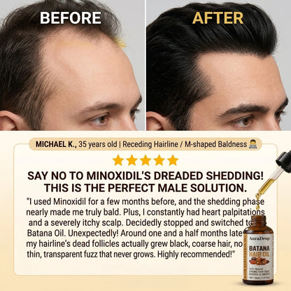 𝐎𝐟𝐟𝐢𝐜𝐢𝐚𝐥 𝐔𝐒 𝐒𝐭𝐨𝐫𝐞 🇺🇸  |  𝐀𝐮𝐫𝐚𝐃𝐫𝐨𝐩® 𝟏𝟎𝟎% 𝐏𝐮𝐫𝐞 𝐁𝐚𝐭𝐚𝐧𝐚 · 𝐕𝐢𝐭𝐚𝐦𝐢𝐧 𝐄 × 𝐎𝐦𝐞𝐠𝐚-𝟔 𝐔𝐥𝐭𝐫𝐚-𝐌𝐢𝐜𝐫𝐨 𝐌𝐨𝐥𝐞𝐜𝐮𝐥𝐚𝐫 𝐑𝐞𝐠𝐫𝐨𝐰𝐭𝐡 𝐎𝐢𝐥 — 𝟔𝟎 𝐒𝐞𝐜𝐨𝐧𝐝𝐬 𝐍𝐢𝐠𝐡𝐭𝐥𝐲, 𝐕𝐢𝐬𝐢𝐛𝐥𝐞 𝐁𝐚𝐛𝐲 𝐇𝐚𝐢𝐫𝐬 𝐢𝐧 𝟒 𝐖𝐞𝐞𝐤𝐬
