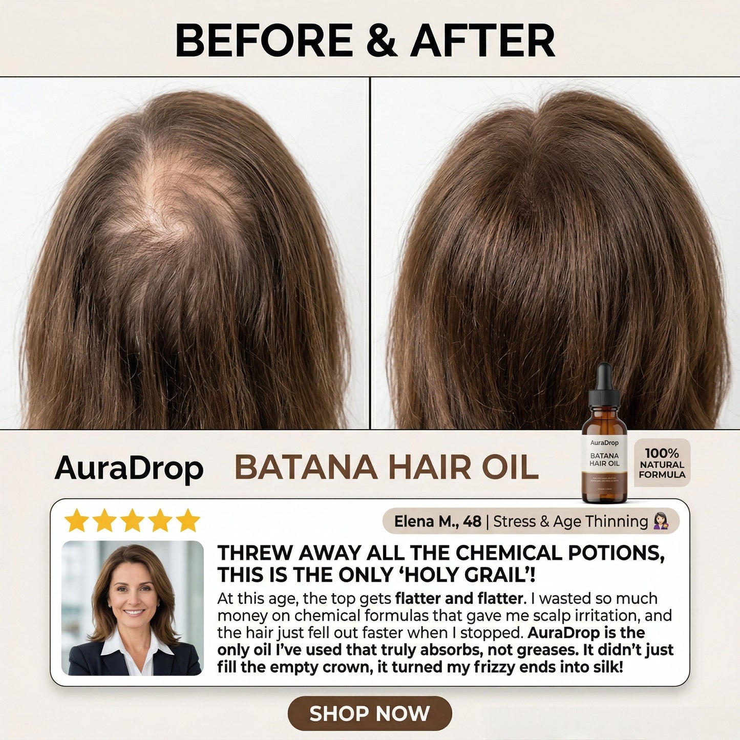 𝐎𝐟𝐟𝐢𝐜𝐢𝐚𝐥 𝐔𝐒 𝐒𝐭𝐨𝐫𝐞 🇺🇸  |  𝐀𝐮𝐫𝐚𝐃𝐫𝐨𝐩® 𝟏𝟎𝟎% 𝐏𝐮𝐫𝐞 𝐁𝐚𝐭𝐚𝐧𝐚 · 𝐕𝐢𝐭𝐚𝐦𝐢𝐧 𝐄 × 𝐎𝐦𝐞𝐠𝐚-𝟔 𝐔𝐥𝐭𝐫𝐚-𝐌𝐢𝐜𝐫𝐨 𝐌𝐨𝐥𝐞𝐜𝐮𝐥𝐚𝐫 𝐑𝐞𝐠𝐫𝐨𝐰𝐭𝐡 𝐎𝐢𝐥 — 𝟔𝟎 𝐒𝐞𝐜𝐨𝐧𝐝𝐬 𝐍𝐢𝐠𝐡𝐭𝐥𝐲, 𝐕𝐢𝐬𝐢𝐛𝐥𝐞 𝐁𝐚𝐛𝐲 𝐇𝐚𝐢𝐫𝐬 𝐢𝐧 𝟒 𝐖𝐞𝐞𝐤𝐬