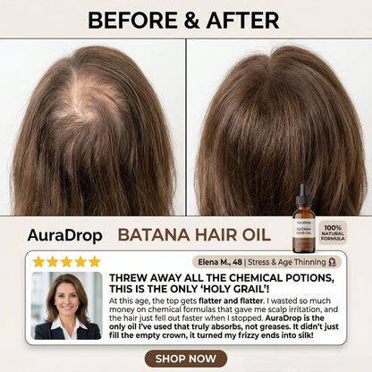 𝐎𝐟𝐟𝐢𝐜𝐢𝐚𝐥 𝐔𝐒 𝐒𝐭𝐨𝐫𝐞 🇺🇸  |  𝐀𝐮𝐫𝐚𝐃𝐫𝐨𝐩® 𝟏𝟎𝟎% 𝐏𝐮𝐫𝐞 𝐁𝐚𝐭𝐚𝐧𝐚 · 𝐕𝐢𝐭𝐚𝐦𝐢𝐧 𝐄 × 𝐎𝐦𝐞𝐠𝐚-𝟔 𝐔𝐥𝐭𝐫𝐚-𝐌𝐢𝐜𝐫𝐨 𝐌𝐨𝐥𝐞𝐜𝐮𝐥𝐚𝐫 𝐑𝐞𝐠𝐫𝐨𝐰𝐭𝐡 𝐎𝐢𝐥 — 𝟔𝟎 𝐒𝐞𝐜𝐨𝐧𝐝𝐬 𝐍𝐢𝐠𝐡𝐭𝐥𝐲, 𝐕𝐢𝐬𝐢𝐛𝐥𝐞 𝐁𝐚𝐛𝐲 𝐇𝐚𝐢𝐫𝐬 𝐢𝐧 𝟒 𝐖𝐞𝐞𝐤𝐬