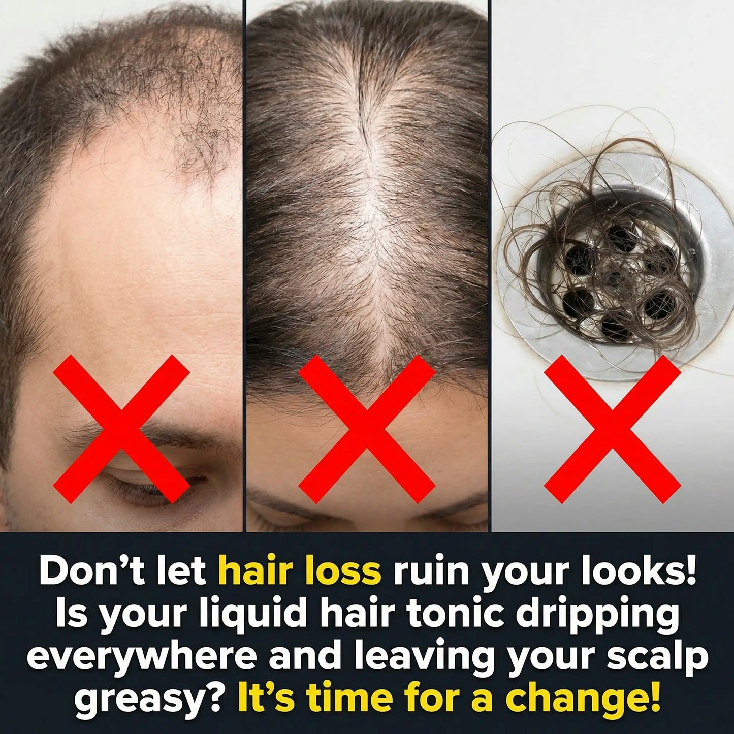 𝐎𝐟𝐟𝐢𝐜𝐢𝐚𝐥 𝐔𝐒 𝐒𝐭𝐨𝐫𝐞 ⭐💖🇺🇸  | Regrow Thicker Hair: EPIGENIX® 5% Minoxidil Pre-Shampoo Cream (No Grease!)